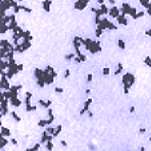 Bacteria as seen under light microscope