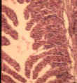 Fish gill with hyperplasia