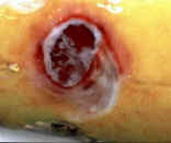 Bacterial ulcer on the body of a koi
